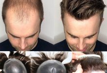 mens hair pieces