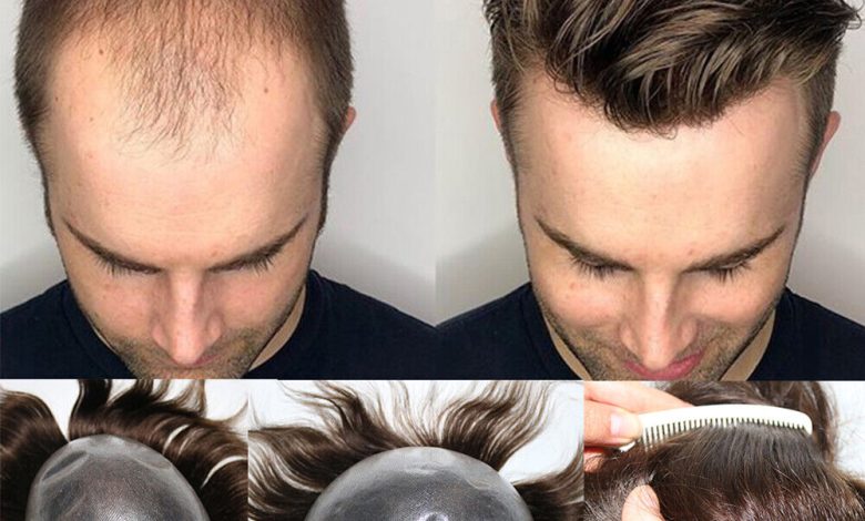 mens hair pieces