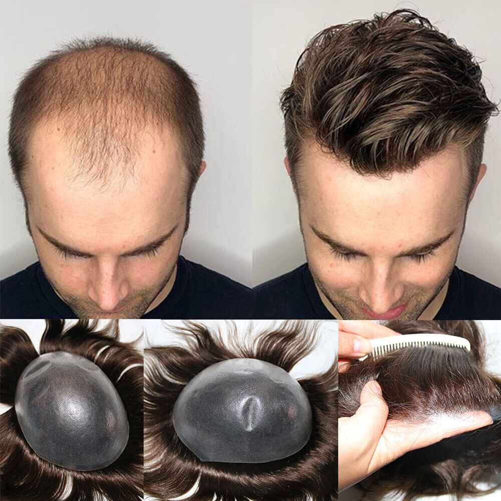 mens hair pieces