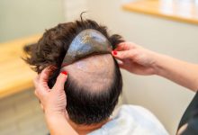 toupee for men