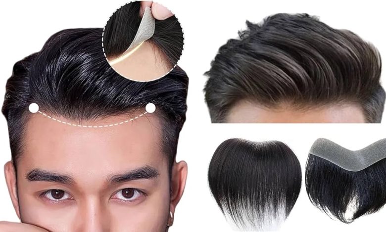 Hair systems for men