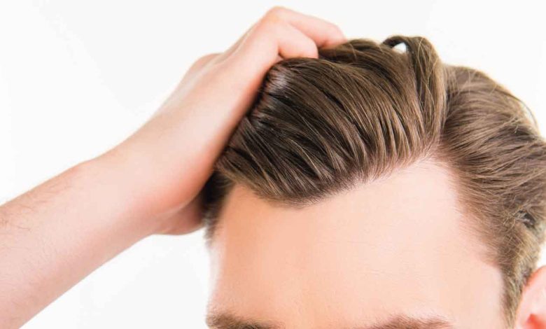 Best Hair Systems for Men
